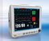 NIBP Measurement Patient Monitor Machine With Patient Info Input Management Function