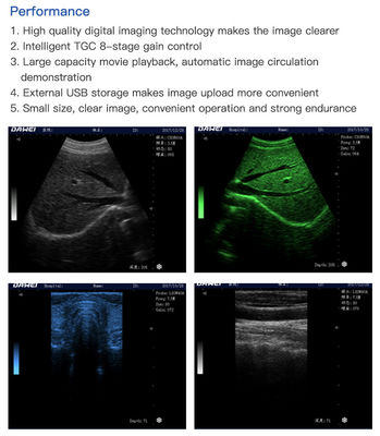 Multilingual USB Port Color Doppler Ultrasound Scanner