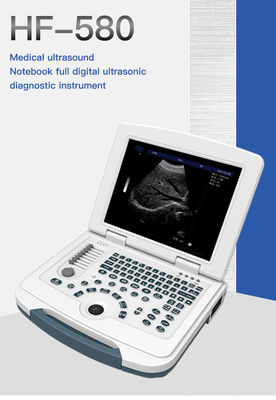 Multilingual USB Port Color Doppler Ultrasound Scanner