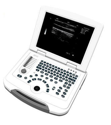 250mm Depth LED Display Medical Ultrasound Scanner