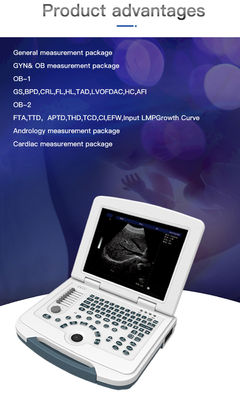 250mm Depth LED Display Medical Ultrasound Scanner