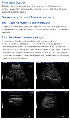 4 Probe Trolley 4D Color Doppler Ultrasound Scanner