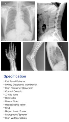 20KW 50KW Medical X Ray Radiological Equipment Lightweight