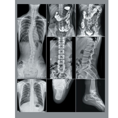 140KHU Radiography X Ray Equipment 2800r/Min High Frequency