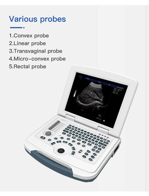 Multilingual USB Port Color Doppler Ultrasound Scanner PRF Adjustable